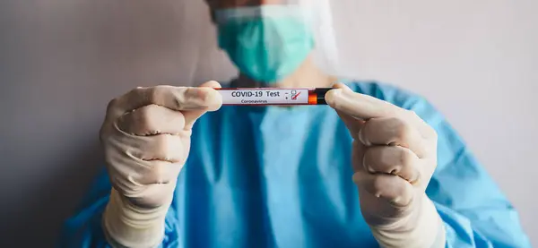 Scientist doctor wearing medical scrubs and holding a sample test tube with blood for 2019-nCoV analyzing. Conceptual of laboratory testing for the respiratory coronavirus disease.