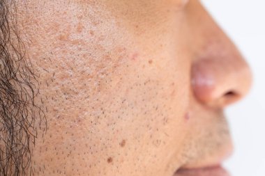 Erkeklerin yanaklarında büyüyen sakalların yan görüntüsü. Yüz kılları, yüzdeki kıllardır..