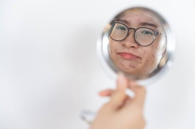 Genç Asyalı bir kadın mini aynada sivilce ve yara izini görünce yüzü için endişelenmiş. Kadın yüzünde akne ve problem derisinin kavramsal görüntüsü.