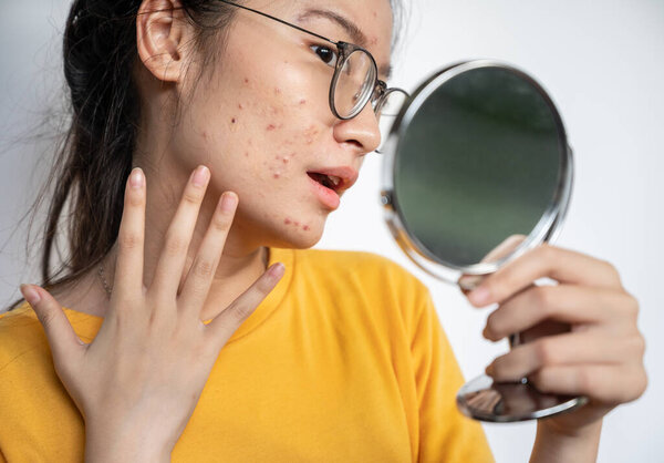 Young Asian woman feeling shock while looking acne and scar occur on face by mini mirror. Conceptual shot of Acne and Problem Skin on female face.