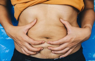 Erkeğin yağlı karnına dokunduğu, erkeklerin göbek yağlarını tuttuğu yakın plan. Aşırı kilolu olmak, kalp hastalığı, felç, yüksek tansiyon gibi büyük hastalıkların başlıca nedenlerinden biridir..