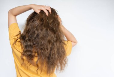 Kafasını kaşıyan genç bir kadının kafa derisi kaşınıyor. Kepek ve deri iltihabı, kaşındıran kafa derisinin en yaygın nedenleridir..