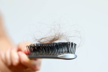 Saç dökülmesi ve bakım üzerine odaklanmış, elinde tarak tutan bir kadının yakın plan görüntüsü. Saç dökülmesi tedavisi kadın tarağı. Kadın eli tarağı yakından tutuyor..