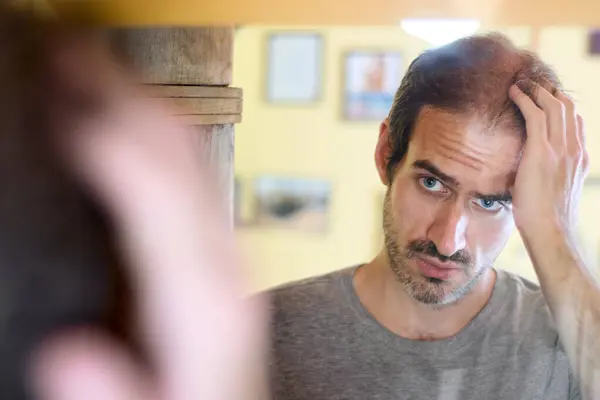 30 yaşında, kısa sakallı beyaz bir adam aynada aynadaki yansımasına bakıyor. Saçının dökülmesinden korkuyor. Metin için alanı kopyala.