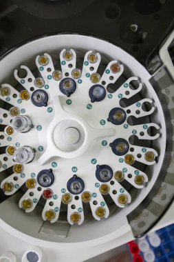 Kan ve idrarın santrifüjlenmesi. Biyokimya laboratuvarında analizler.