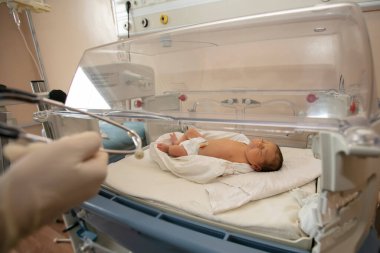 Yenidoğan bilimi. Hastanede bebekler için özel bir kuvözde doğan bir bebek..
