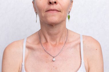 Yaşlı bir kadının yaşlanma belirtilerine sahip yüzünün bir parçası. Yaşlanan yüz derisi.