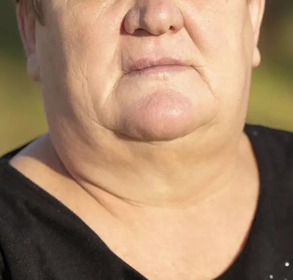一个肥胖的六十岁女人脸上的衰老迹象 一个肥胖的六十岁女人脸上的衰老迹象 双下巴 免版税图库图片