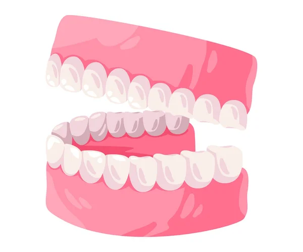 Üst Alt Çene Ağız Diş Etleri Diş Ortodontik Vektör Çizim — Stok Vektör