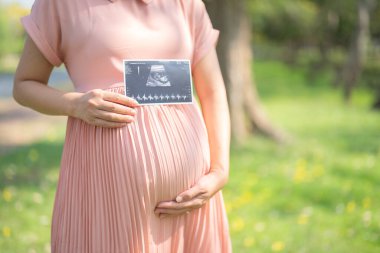 Mutlu Asyalı hamile kadın portresi halka açık bahçe parkında tatilde yürüyor. Anne sevgisi. Bebek sahibi olmak. Aile hayatı..