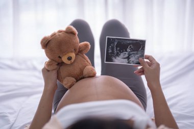 Bebek ultrasonu olan mutlu Asyalı hamile bir kadının portresi. Bebek sahibi olmak. Aile hayatı işte. Annen seni seviyor.