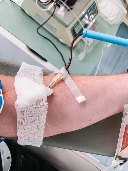 stock image The hand of a man who donates blood. Male donor gives blood in a mobile blood donation center