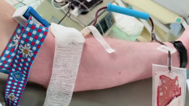 献血的人的手 男性捐献者在流动献血中心献血 戴防护手套的护士的手血液样本 — 图库视频影像