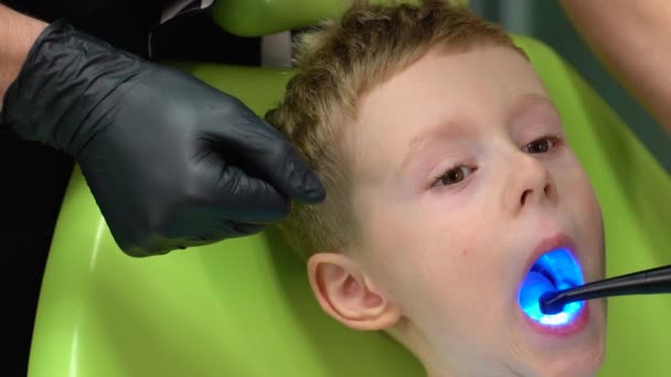 Zahnarzt Kieferorthopäde Der Mit Blauer Bleaching Lampe Operiert Zähne Heilt — Stockvideo