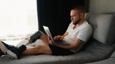 Protez bacaklı bir programcı rahat bir şekilde bir koltukta oturuyor ve modern bir dairede dizüstü bilgisayarıyla çalışıyor.