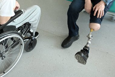 Kemik nakli yapılmış bacak protezleri olan bir adam. osteointegrasyon