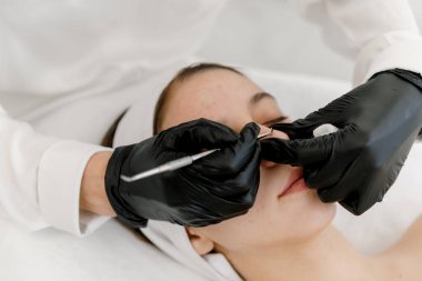 Mekanik ya da manüel yüz temizleyici kadının yüzü. Genç suratından sivilceler ve siyah noktalar çıkaran bir güzellik uzmanı. Gençlik teni. Sivilce ve hijyen kavramı.