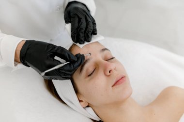 Mekanik ya da manüel yüz temizleyici kadının yüzü. Genç suratından sivilceler ve siyah noktalar çıkaran bir güzellik uzmanı. Gençlik teni. Sivilce ve hijyen kavramı.