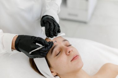 Mekanik ya da manüel yüz temizleyici kadının yüzü. Genç suratından sivilceler ve siyah noktalar çıkaran bir güzellik uzmanı. Gençlik teni. Sivilce ve hijyen kavramı.