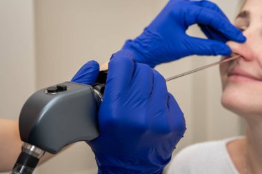 Özel bir tıbbi aletle genç bir kızın burnunun otolaringolojistin ofisinde muayene, muayene. Seçici odak