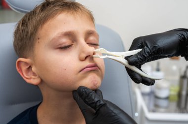 Burun muayenesi, küçük çocuk, sarışın genç endişeli, otoların ofisinde oturuyor, doktordaki burun deliklerini inceliyor, duygusal. Tedavi ilaçları