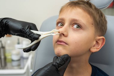 Burun muayenesi, küçük çocuk, sarışın genç endişeli, otoların ofisinde oturuyor, doktordaki burun deliklerini inceliyor, duygusal. Tedavi ilaçları