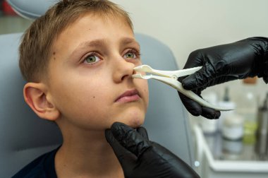 Burun muayenesi ve muayenesi, küçük çocuk, gülümseyen sarışın genç, otolaringolojistin ofisinde oturuyor, doktordaki burun deliklerini inceliyor, güvenen, duygusal, gülümseyen. Fiziksel muayene.