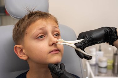 Burun muayenesi ve muayenesi, küçük çocuk, gülümseyen sarışın genç, otolaringolojistin ofisinde oturuyor, doktordaki burun deliklerini inceliyor, güvenen, duygusal, gülümseyen. Fiziksel muayene.