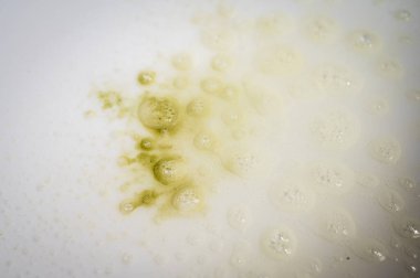 Beyaz bir yüzey üzerinde sarı-yeşilimsi, kabarcıklı sıvı bir lekenin yakın çekimi. Kirli döküntü, sabun köpüğü, ya da köpük ve köpükle kimyasal reaksiyon dokusu temizlemek.
