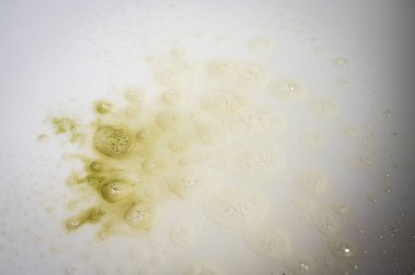 Beyaz bir yüzey üzerinde sarı-yeşilimsi, kabarcıklı sıvı bir lekenin yakın çekimi. Kirli döküntü, sabun köpüğü, ya da köpük ve köpükle kimyasal reaksiyon dokusu temizlemek.