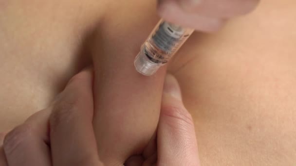 Seorang Wanita Menyuntikkan Hormon Dalam Perut Dengan Jarum Suntik Rumah — Stok Video