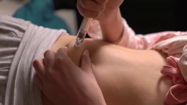 Een Vrouw Hormonen Injecteren Maag Met Een Spuit Thuis Hormoontherapie — Stockvideo