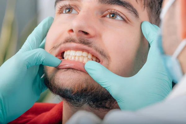 Dłonie Dentysty Sprawdzającego Protezę Zęba Pacjenta Klinice — Zdjęcie stockowe