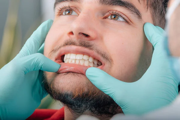 Dłonie Dentysty Sprawdzającego Protezę Zęba Pacjenta Klinice — Zdjęcie stockowe