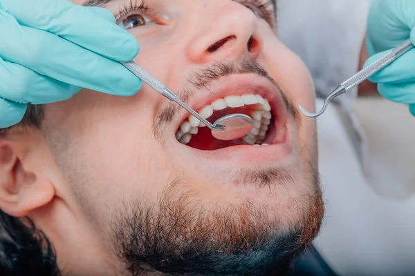 Usta Pacjenta Narzędziami Dentystycznymi — Zdjęcie stockowe