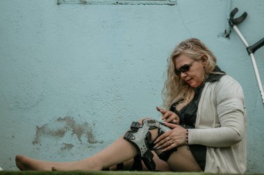 Ortopedik protezi olan engelli kadın.