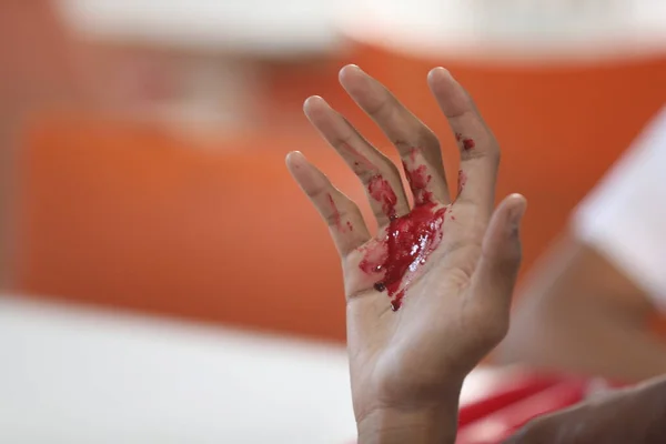 Männliche Hand Mit Blut — Stockfoto