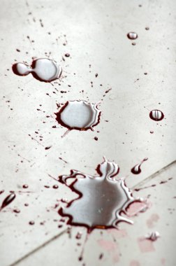 Hindistan 'daki Kan Hastanesinin Kapanışı