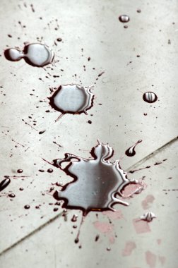 Hindistan 'daki Kan Hastanesinin Kapanışı