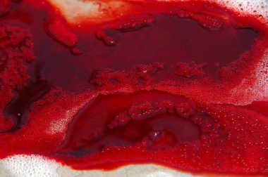 Hindistan 'daki Kan Hastanesinin Kapanışı