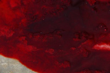 Hindistan 'daki Kan Hastanesinin Kapanışı