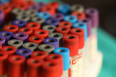 Kan testi tıbbi tüpleri.