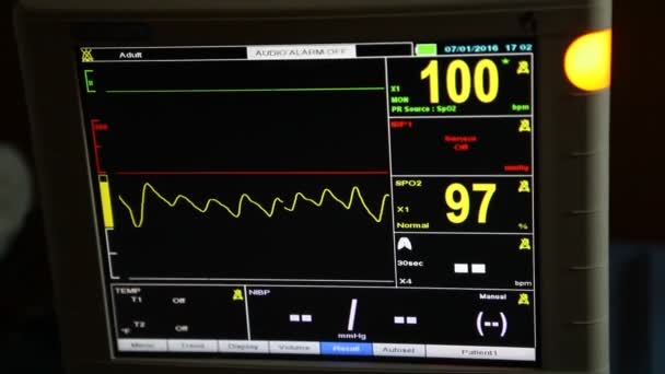 Kórházi Felszerelés Intenzíven — Stock videók