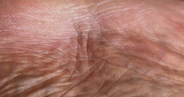 İnsan Derisi Makro Vuruşu