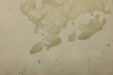 Cam yüzeyde canlı yağ kabarcıkları