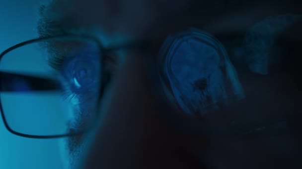 Manliga Läkare Ögon Glasögon Sent Natten Tittar Framför Mrt Data — Stockvideo