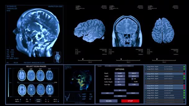 Mri Skenování Mozku Animace Neurologické Údaje Vitální Funkce Displeji Budoucí — Stock video