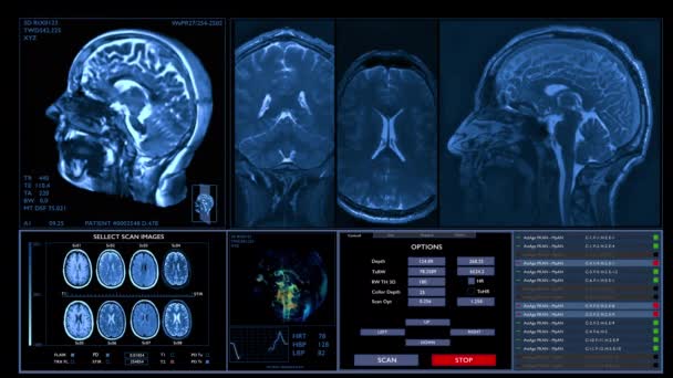 Мрт Сканирование Мозга Данные Неврологии Жизненные Показатели Дисплее Технологии Будущего — стоковое видео