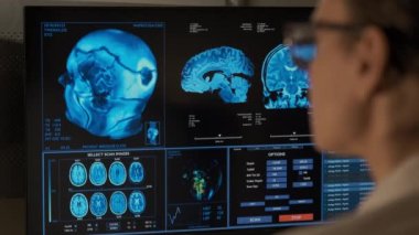 Woman Doctor analyzing MRI in a hospital office. High quality 4k footage