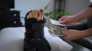 An injured leg with a black nail in a bandage. Money is counted. High quality 4k footage